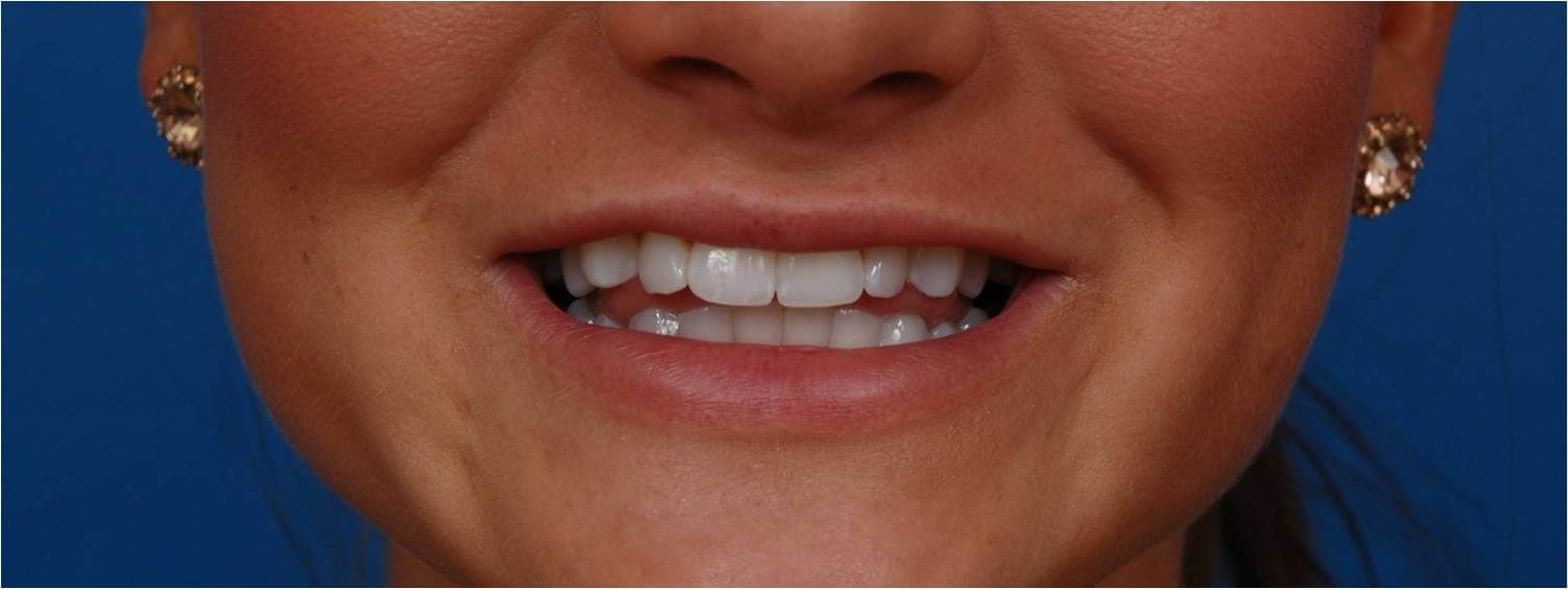 Before Image